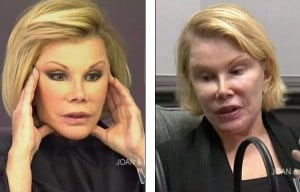 Joan Rivers Plastic Surgery Without Makeup Photos Cosmetic