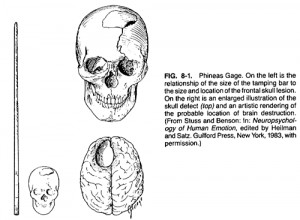 Traumatic Brain Injury