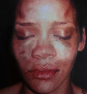 thumbs rihanna beaten face We couldnt decide whether to report on this ...
