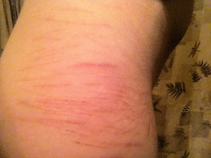 Quotes About Cutting Scars For picture