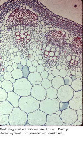 medicago stem cross section early development of vascular ca