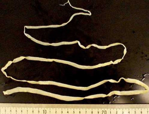 Tapeworms are the largest of the parasites.
