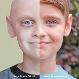 Striking Before-And-After Photo Illustrates Childhood Cancer Survivor ...