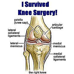 knee_surgery_gift_10_greeting_cards_pk_of_10.jpg?height=250&width=250 ...