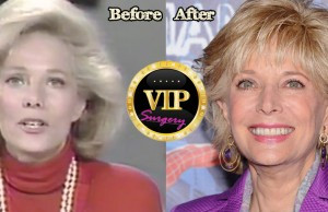 lesley stahl before and after photos stahl ing age news reporting