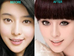 Plastic Surgery Before And