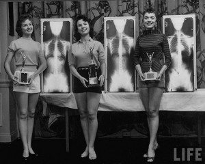Chiropractor Beauty Contest, Wallace Kirkland, 1956.