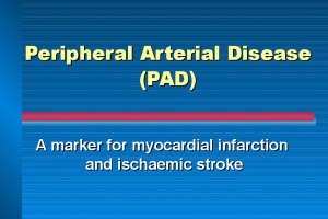 Peripheral Arterial Disease...