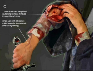 Harry's wound because of the bite of Slytherin's Basilisk 03