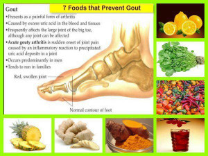 foods that prevent gout gout is a disease that is caused by uric ...