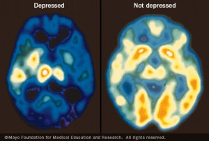 Learn more about depression and its signs and symptoms .