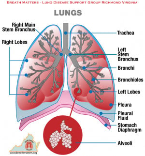 Lung Disease Support Group Breath Matters