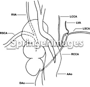 Right Subclavian Artery Anatomy