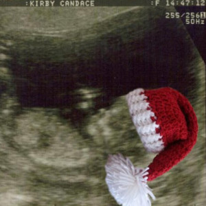 santa-ultrasound-announcing-pregnancy-candy-kirby-420x420