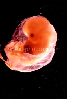 Human Embryo 8 Weeks Old