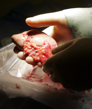 Friday, Jan. 09, 2009