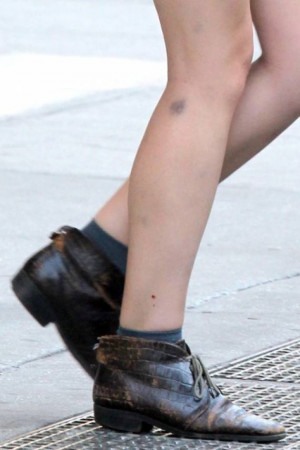 Taking photos of the bruises she picks up while making movies