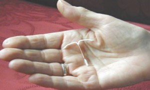 We encourage all Take Charge providers to offer long-acting reversible ...