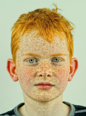 blue eyes, freckles, red hair
