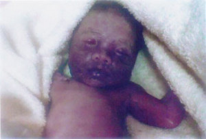 Dead Baby Sparks Legal Row