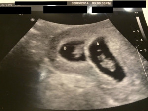 Pregnancy Quotes HD Wallpaper 23