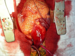 ... carlile doctor of mice and men surgery attack attack Warped Tour