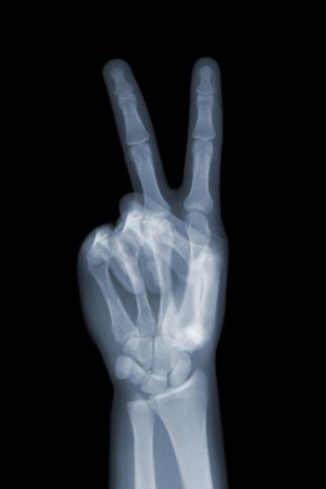 Nick Veasey - Peace, Ed. II/V