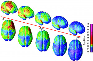 Brain Maturation in the Human Teenager (Post Includes Cool Videos)