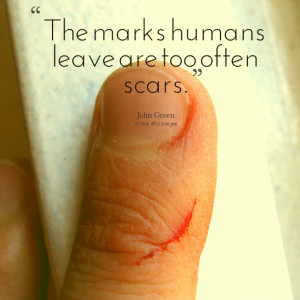 Quotes Picture: the marks humans leave are too often scars