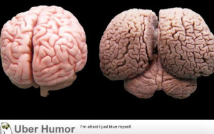 human brain on the left, a dolphin brain on the right