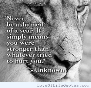 related posts never be ashamed of a scar never be ashamed of a scar ...