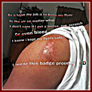 It hurts but i keep it moving. Love cheerleading