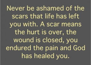 Scars in life...(thank) GOD has HEALED you! ;)