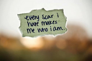 have a lot of scars, and they are very exposed right now.