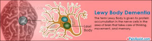 Lewy Body Dementia Symptoms