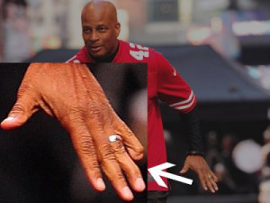 Hall of Famer Ronnie Lott had the tip of his left pinky finger ...