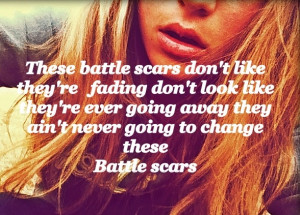 that calms me down is the song Battle Scars bc I have battles scars ...