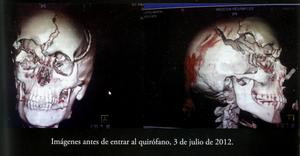 Thread: Former Marussia test driver Maria de Villota found dead