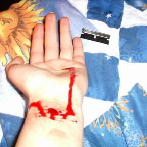 wrist cut photo wristcut.jpg