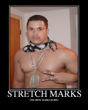 before stretch marks and tummy tuck scar tattoos for women that hide