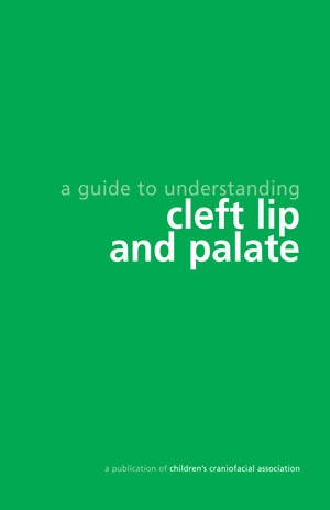 Cleft Lip & Palate http://ccakids.org/Syndrome/CleftLipPalate.pdf