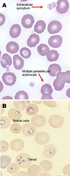babesiosis parasitos sangre garrapatas popscreen