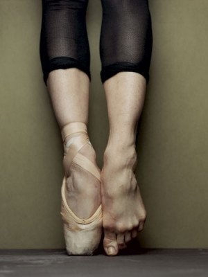 Dancer's Feet in CT