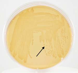 Serratia Marcescens On MacConkey Agar