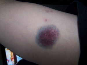 Cleared both up pretty quickly.