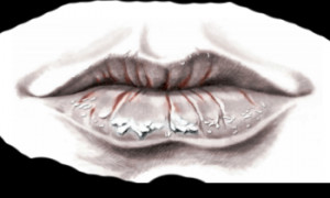 lips care lipstic art share tweet healing your lips lips crack and