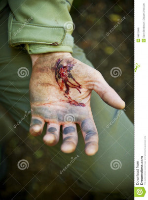 Stock Photo: Injured Hand Cut Blood HD Wallpaper