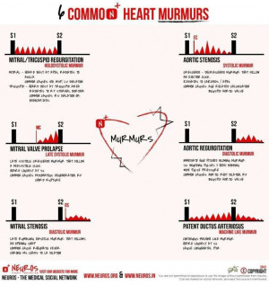 Heart murmurs: Nur Students, Internet Site, Cardiac Murmur, Medical ...