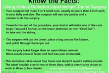 KIDNEY TRANSPLANT & DONOR INFO / Information about kidney transplant ...