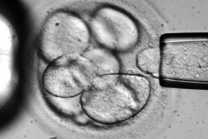 advanced cell technology ap a single cell is removed from